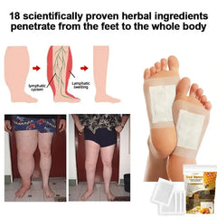 Bee Venom Lymphatic Drainage & Slimming Foot Patches ๐ฟ๐ฃ