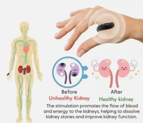 LI4 Acupressure Clip for Sugar Balance & Wellness